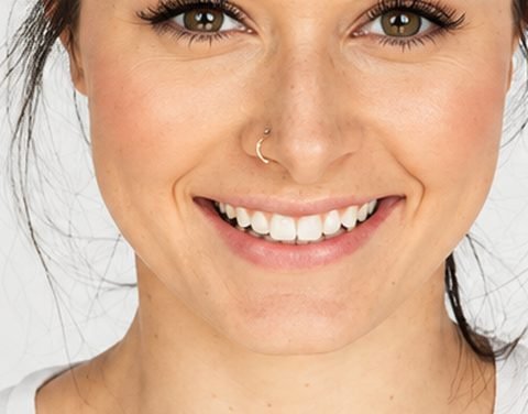 Confident, aligned smile after orthodontic treatment