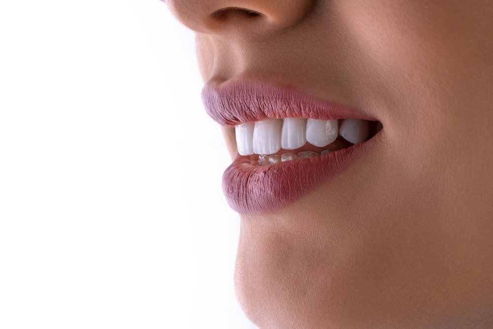 A close-up of white, healthy teeth after a whitening treatment